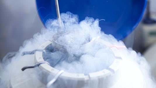 SHOULD I HAVE CRYOPRESERVATION OF MY SPERM PRIOR TO VASECTOMY?