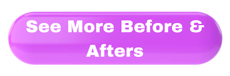 See more before and afters penile enlargement